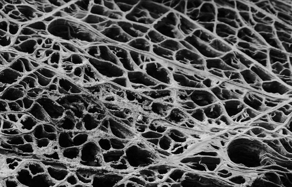Hadopelagyal – Zalmathic Necroichorion